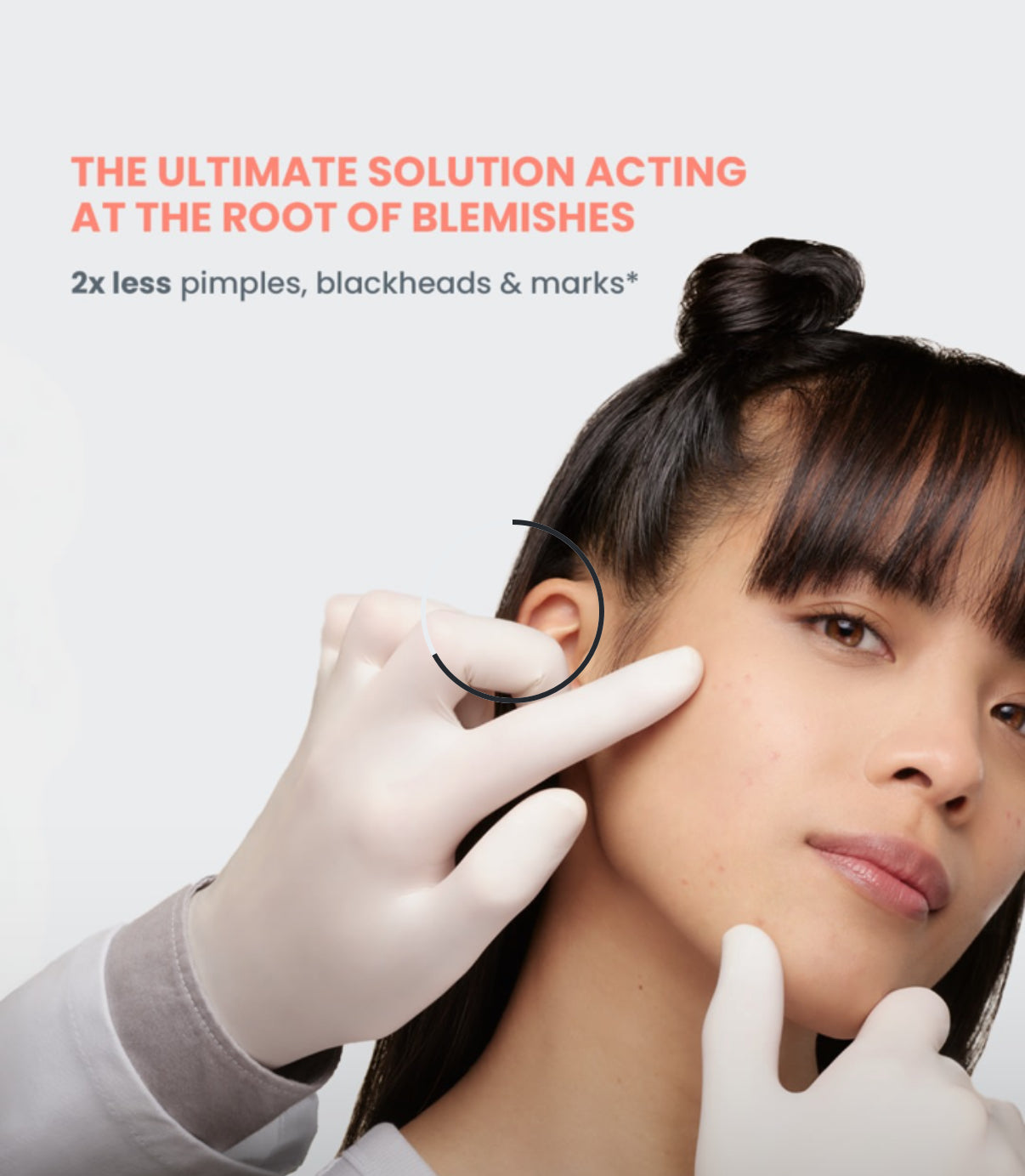 Avène cleanance comedomed Anti imperfections